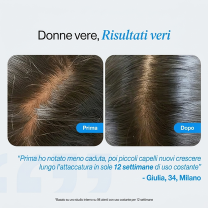 Rinata Siero Roll-On per la Crescita dei Capelli